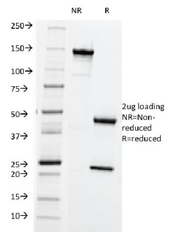 Anti-HLA-ABC (MHC I) Monoclonal Antibody(Clone: SPM419)