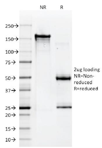 Anti-HLA-A (MHC I) Monoclonal Antibody(Clone: 108-2C5)