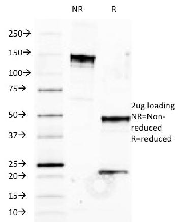 Anti-HLA-B (MHC Class I) Monoclonal Antibody(Clone: JOAN-1)