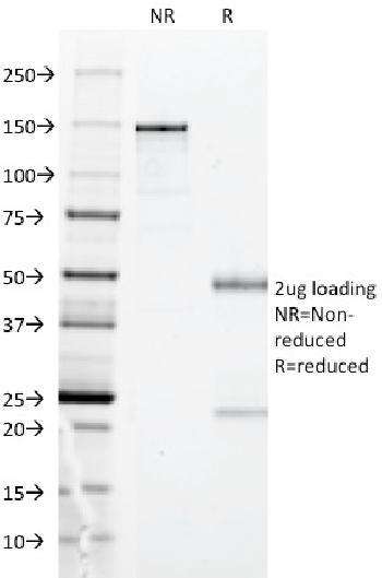 Anti-HLA-DP (MHC II) Monoclonal Antibody(Clone: BRA-FB6)