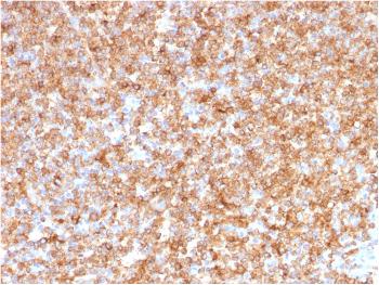 Anti-HLA-DP/-DQ/-DR (MHC II) Monoclonal Antibody(Clone: CR3/43)