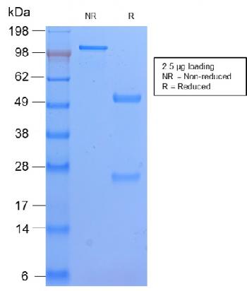 Anti-HLA-DP (MHC II) Monoclonal Antibody(Clone: HLA-DPB1/2862R)