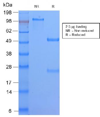 Anti-HLA-DQ (MHC II) Monoclonal Antibody(Clone: HLA-DQA1/2866R)