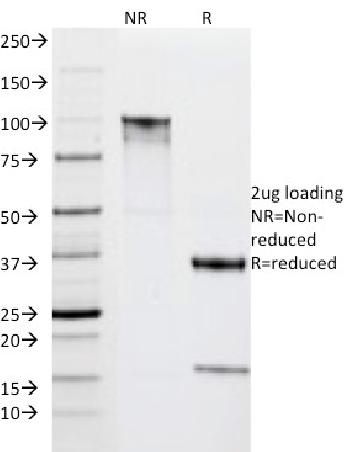 Anti-HLA-DRA (MHC II) Monoclonal Antibody(Clone: IPO-10)