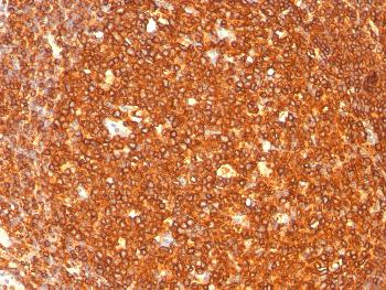 Anti-HLA-DR (MHC II) Monoclonal Antibody(Clone: SPM289)