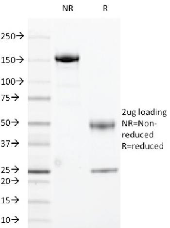 Anti-HLA-DRA (MHC II) Monoclonal Antibody(Clone: 169-1B5.2)