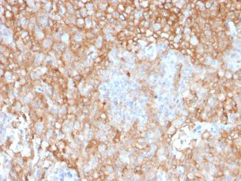 Anti-HLA-DR (MHC II) Monoclonal Antibody(Clone: TAL 1B5)