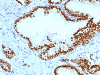 Anti-FOXA1 / HNF3A Monoclonal Antibody(Clone: FOXA1/1241)