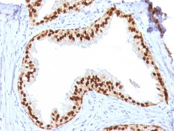 Anti-FOXA1 / HNF3A Monoclonal Antibody(Clone: FOXA1/1512)