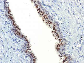 Anti-FOXA1 / HNF3A Monoclonal Antibody(Clone: FOXA1/1514)