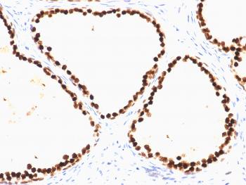 Anti-FOXA1 / HNF3A Monoclonal Antibody(Clone: FOXA1/1515)