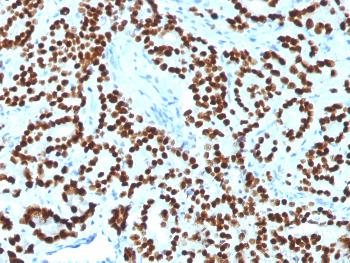 Anti-FOXA1 / HNF3A Monoclonal Antibody(Clone: FOXA1/1518)