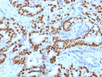 Anti-FOXA1 / HNF3A Monoclonal Antibody(Clone: FOXA1/1519)