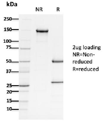 Anti-APC / Adenomatous Polyposis Coli / FAP (Tumor Suppressor) Monoclonal Antibody(Clone: ALi 12-28)