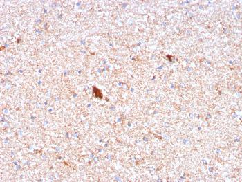 Anti-Serum Amyloid P / APCS Monoclonal Antibody(Clone: APCS/3240)