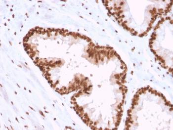 Anti-APEX Nuclease I Monoclonal Antibody(Clone: CPTC-APEX1-2)