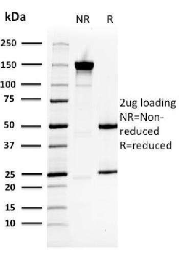 Anti-Heat Shock 27kDa Protein 1 Monoclonal Antibody(Clone: CPTC-HSPB1-2)