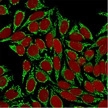 Anti-HSP60 (Heat Shock Protein 60) (Mitochondrial Marker) Monoclonal Antibody(Clone: HSPD1/875)