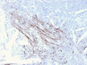 Anti-Tenascin C (Stromal Marker for Epithelial Malignancy) Monoclonal Antibody(Clone: TNC/3635)