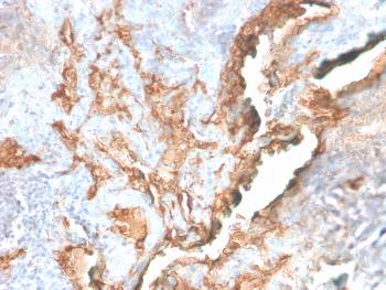 Anti-Tenascin C (Stromal Marker for Epithelial Malignancy) Monoclonal Antibody(Clone: TNC/2981R)