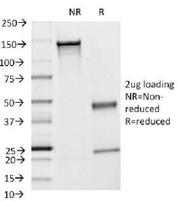 Anti-CD54 / ICAM-1 Monoclonal Antibody(Clone: F4-31C2)