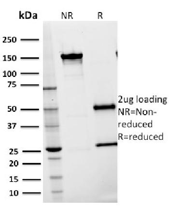 Anti-CD54 / ICAM-1 Monoclonal Antibody(Clone: 15.2)