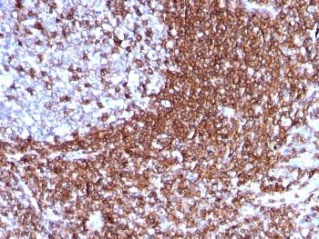 Anti-CD50 / ICAM3 Monoclonal Antibody(Clone: 186-2G9)