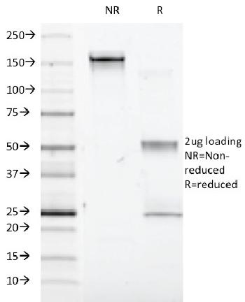 Anti-Interferon alpha-1 (IFNA1) Monoclonal Antibody(Clone: Feb-48)