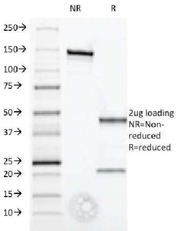 Anti-Interferon alpha-1 (IFNA1) Monoclonal Antibody(Clone: Feb-52)