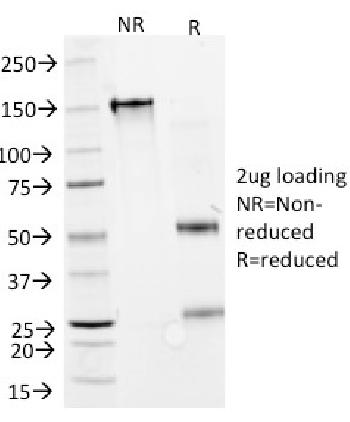 Anti-Interferon alpha-2 (IFNA2) Monoclonal Antibody(Clone: N27)