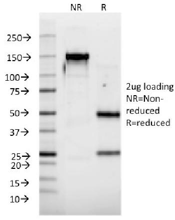 Anti-Interferon alpha-2 (IFNA2) Monoclonal Antibody(Clone: N39)