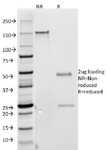 Anti-Interferon gamma (IFNG) Monoclonal Antibody(Clone: G-23)