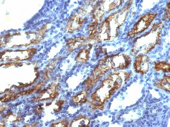 Anti-Interferon gamma (IFNG) Monoclonal Antibody(Clone: IFNG/466)