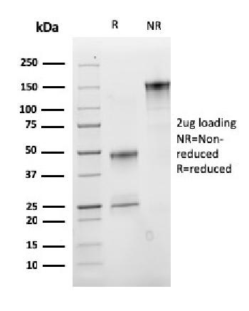 Anti-Insulin-like Growth Factor-1 (IGF-1) Monoclonal Antibody(Clone: M23)