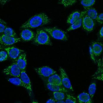 Anti-Insulin-like Growth Factor-1 (IGF-1) Monoclonal Antibody(Clone: IGF1/1020)