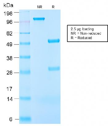 Anti-Insulin-like Growth Factor-1 (IGF-1) Monoclonal Antibody(Clone: IGF1/2872R)