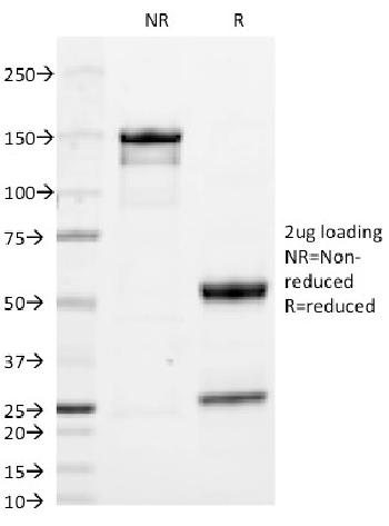 Anti-IgA (Immunoglobulin Alpha Heavy Chain) (B-Cell Marker) Monoclonal Antibody(Clone: HISA43)