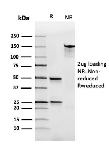 Anti-Immunoglobulin Alpha (IgA) Heavy Chain Monoclonal Antibody(Clone: rHISA43)