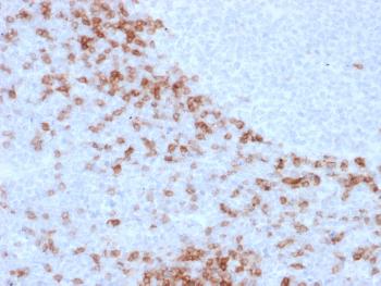 Anti-IgD (Immunoglobulin Delta Heavy Chain) (B-Cell Marker) Monoclonal Antibody(Clone: IgD26)