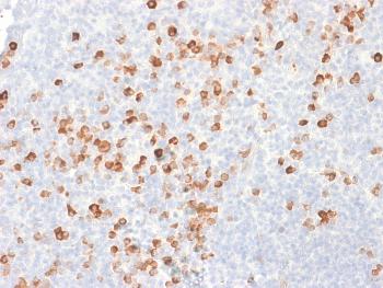 Anti-IgG (Immunoglobulin Gamma Heavy Chain) (B-Cell Marker) Monoclonal Antibody(Clone: rIG266)