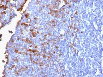 Anti-IgG (Immunoglobulin Gamma Heavy Chain) (B-Cell Marker) Monoclonal Antibody(Clone: IG1707R)