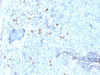 Anti-IgG4 (Ig Heavy Constant Gamma 4) (G4m Marker) Monoclonal Antibody(Clone: IGHG4/1345)