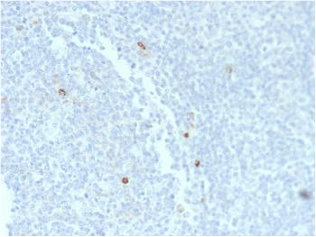 Anti-IgM (Immunoglobulin Mu Heavy Chain) (B-Cell Marker) Monoclonal Antibody(Clone: rIM373)