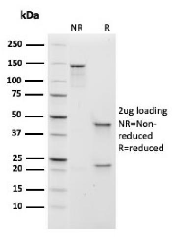 Anti-IgM (Immunoglobulin Mu Heavy Chain) (B-Cell Marker) Monoclonal Antibody(Clone: rIGHM/1623)