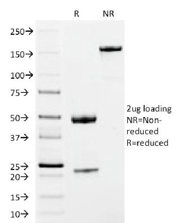 Anti-IgM (Immunoglobulin Mu Heavy Chain) (B-Cell Marker) Monoclonal Antibody(Clone: IM373)-CF488