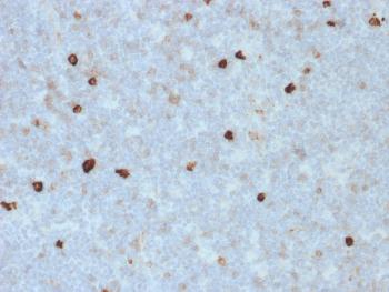 Anti-IgM (Immunoglobulin Mu Heavy Chain) (B-Cell Marker) Monoclonal Antibody(Clone: R1/69)