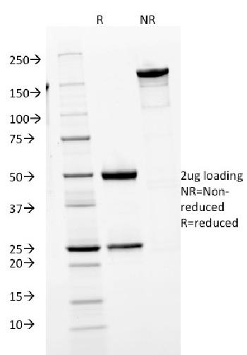 Anti-IgM (Immunoglobulin Mu Heavy Chain) (B-Cell Marker) Monoclonal Antibody(Clone: IGHM/1623)