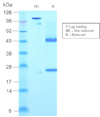 Anti-IgM (Immunoglobulin Mu Heavy Chain) (B-Cell Marker) Monoclonal Antibody(Clone: rIGHM/2558)