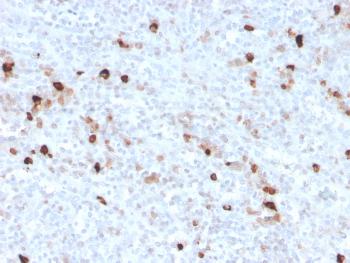 Anti-IgM (Immunoglobulin Mu Heavy Chain) (B-Cell Marker) Monoclonal Antibody(Clone: IGHM/3776R)