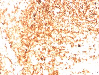 Anti-IgM (Immunoglobulin Mu Heavy Chain) (B-Cell Marker) Monoclonal Antibody(Clone: IGHM/3803R)